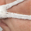Picture of Nasal Bandafix Sling Bandage